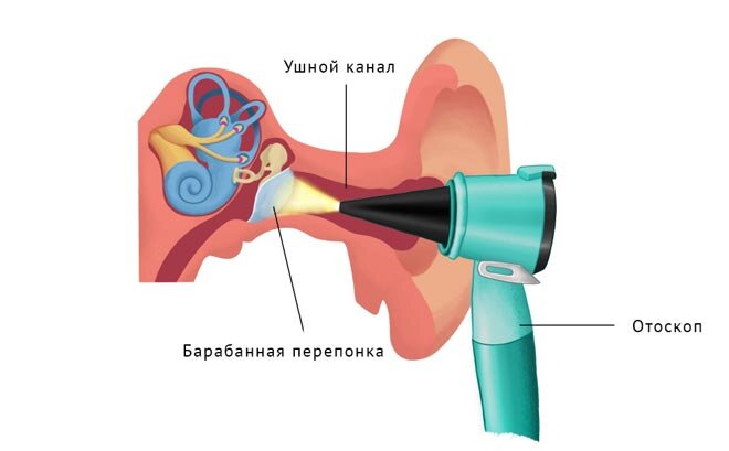 отоскопия