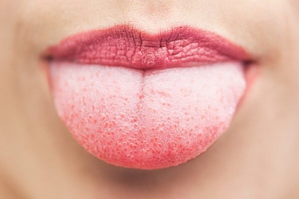     Как снять боль, если вы обожгли язык: 8 проверенных методов