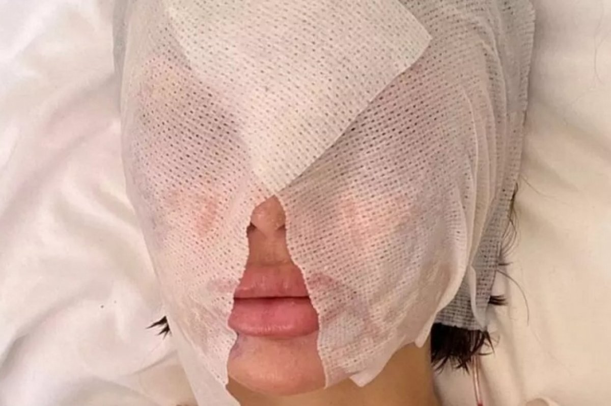    Юрист Алешкин посоветовал обманутым фанатам Бони обратиться в полицию