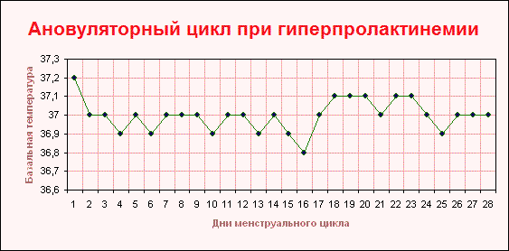 Ановуляторный график БТ при гиперлактинемии