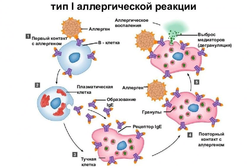 Стадии аллергических реакций I типа