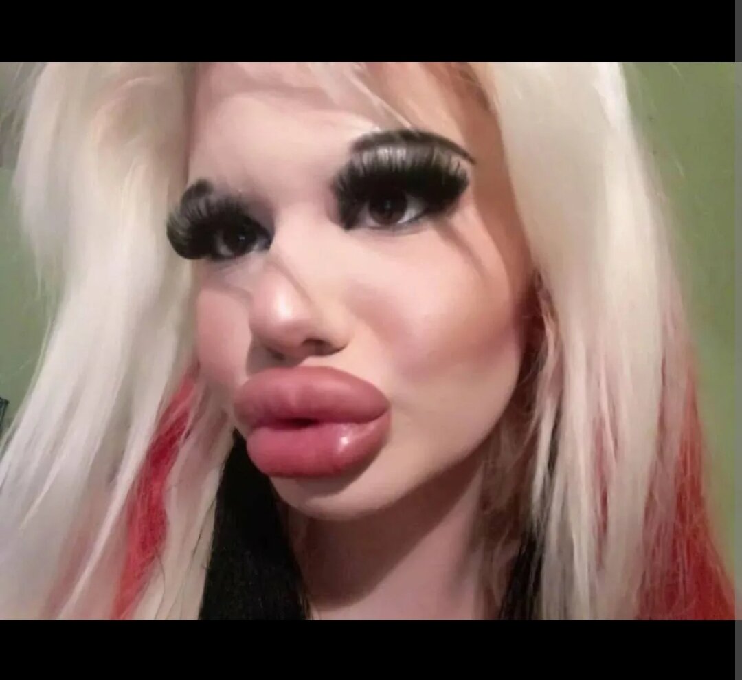 Девушки с силиконовыми губами. Мукла жизель. Жертвы пластических хирургов. Андреа эмилова. Женщины с силиконом.