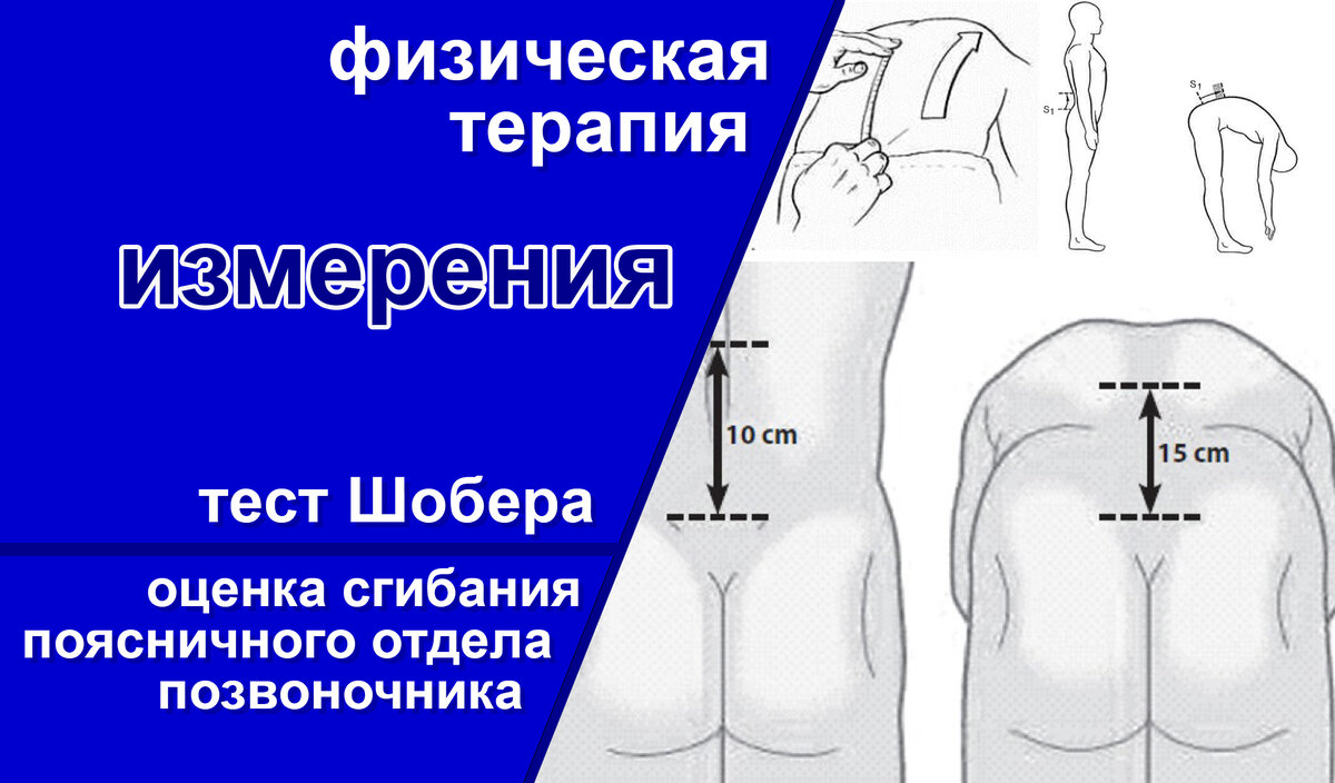 Оценка подвижности поясничного отдела | Тест Шобера | Специалист по физ-й  реабилитации | Бойцов Сергей Н. Новгород | Дзен