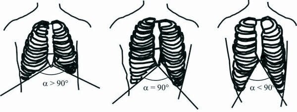 Определение телосложения по межреберному углу