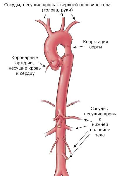 Стеноз артерий – симптомы, причины, признаки, диагностика и лечение в «СМ-Клиника»