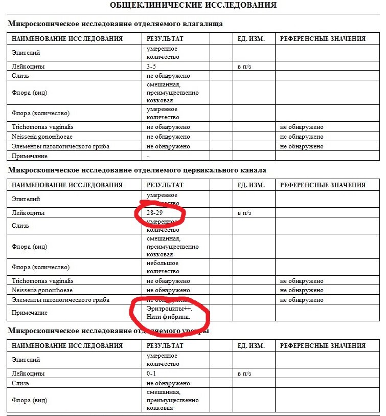 Плохой мазок у женщин. Плохие анализы мазок. Лейкоциты в мазке из влагалища. Плохой мазок перед гистероскопией.