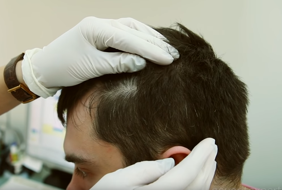 Перхоть можно легко убрать