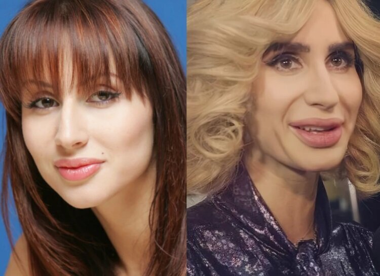 Светлана Лобода потребовала компенсацию от пластического хирурга " Звёзды.ru
