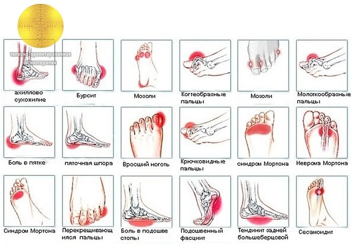 возможные заболевания стопы