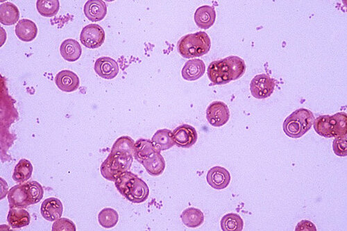 Haemophilus influenzae (палочка Пфайффера)
