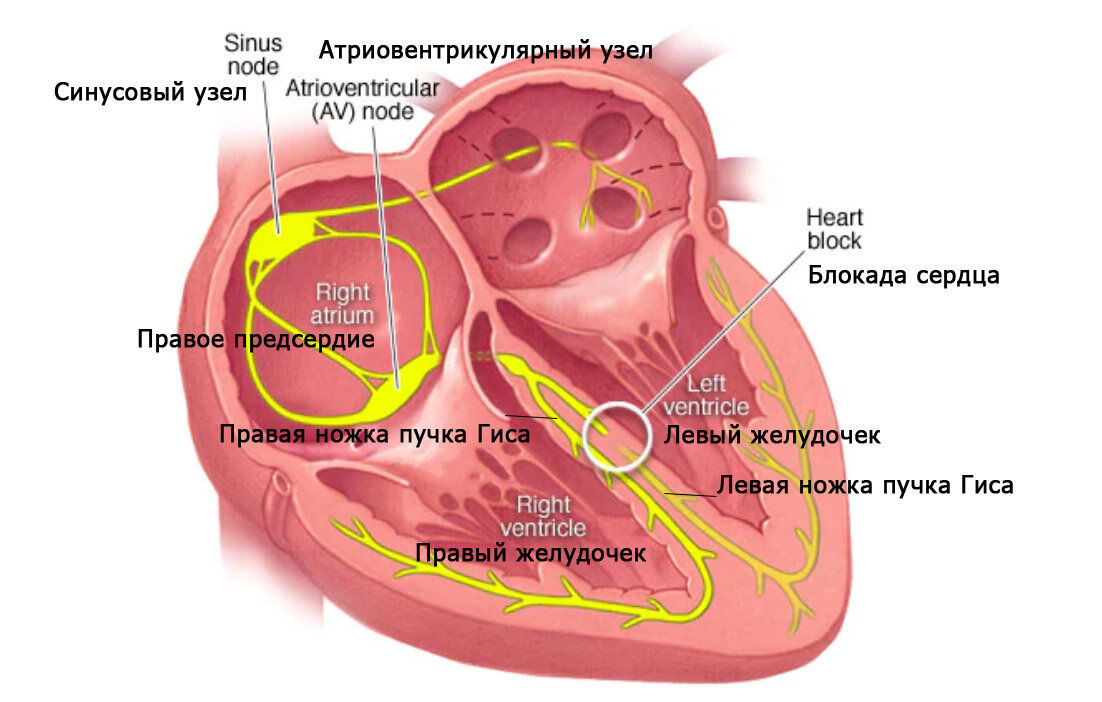 Что такое блокада сердца