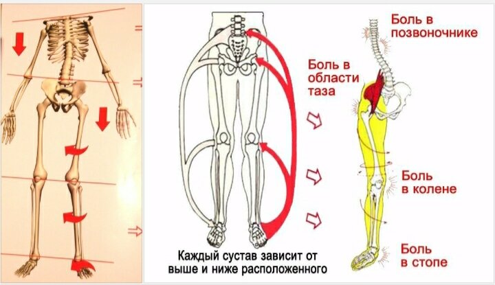 Блуждающие боли по всему телу: причины и лечение - Evexia