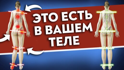 Как исправить ПЕРЕКОС ТЕЛА? Большая асимметрия НЕ норма!