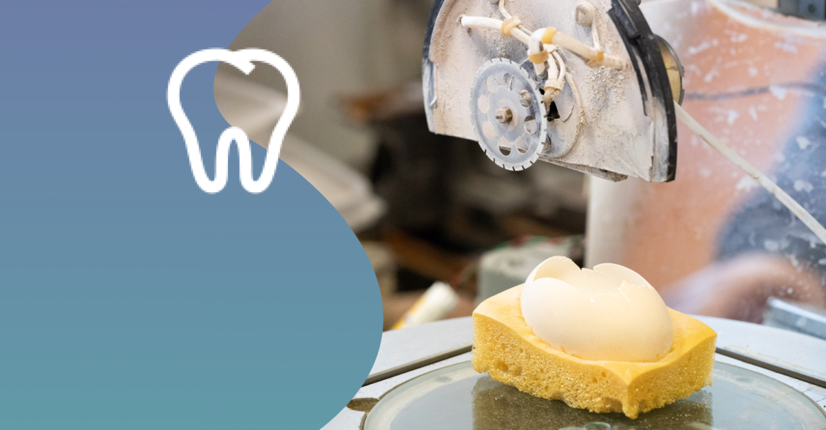 Материал на основе скорлупы можно использовать для склеивания пломбы с зубом. коллаж: медиацентр УрФУ,