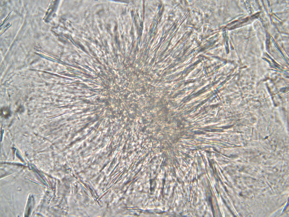 Кристаллизованный мед под микроскопом