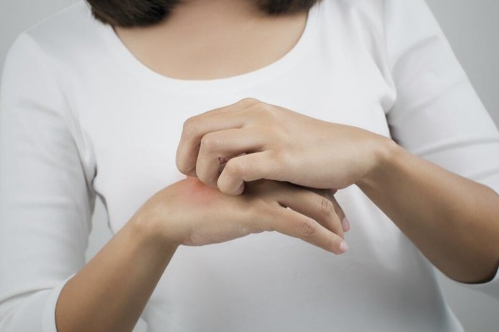 лечение экземы народными средствами