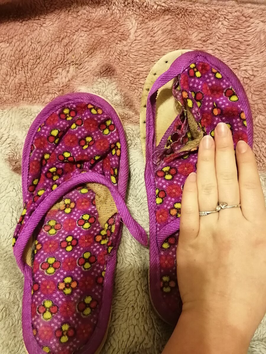 Фото автора. Увидев это, я как-то передумала зашивать... 