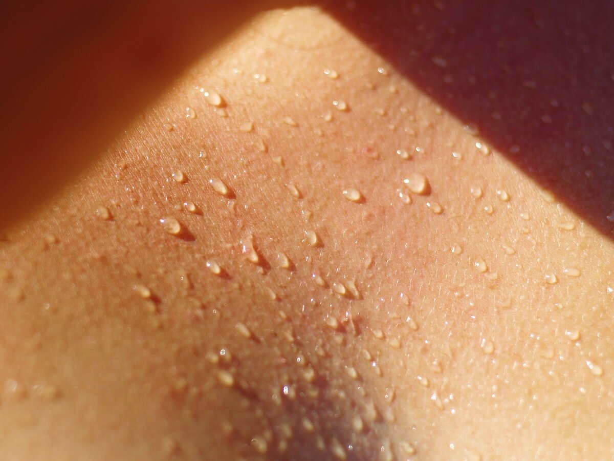 гусиная кожа на груди у женщин фото 108