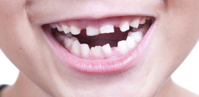 Когда должны прорезываться зубы у ребенка?