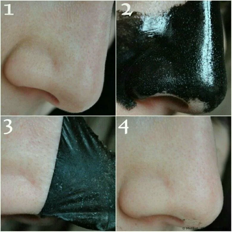 значительное уменьшение черных точек после использования маски.