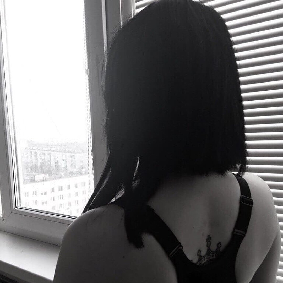 Фото спустя 3 года после трансплантации 