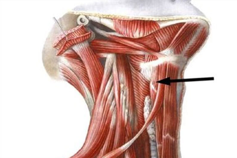 Musculus Longus Colli