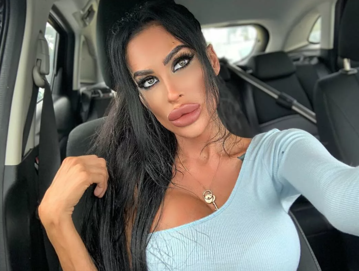 Медсестра Тара Джейн МакКонахи потратила 5,4 млн рублей на улучшение внешности