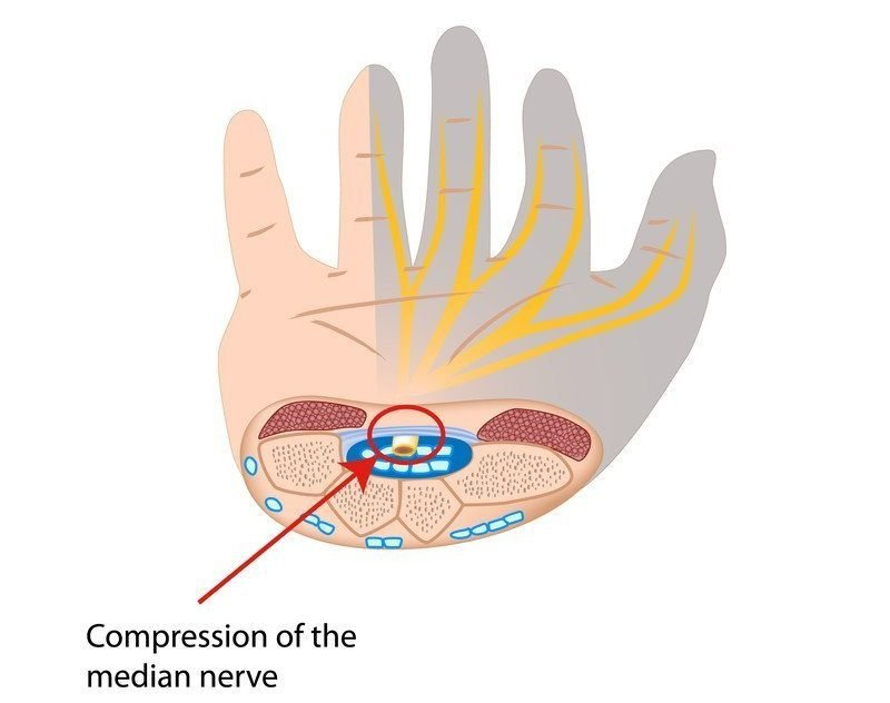 Фото носит иллюстративный характер. Источник фото: Яндекс картинки.