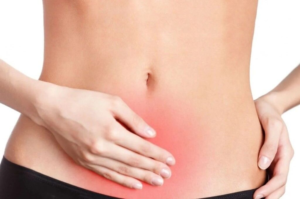 5 заблуждений о цистите