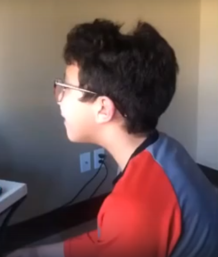 Прическа студента на онлайн-обучении (Это след от наушников)