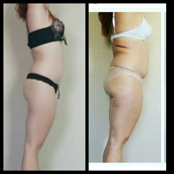 Дальше- больше! 