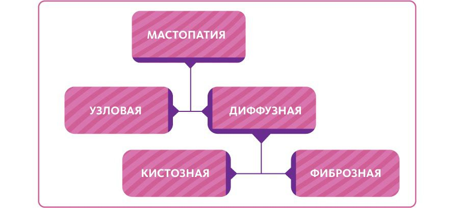 Фиброзно-кистозная мастопатия — болезнь современных женщин