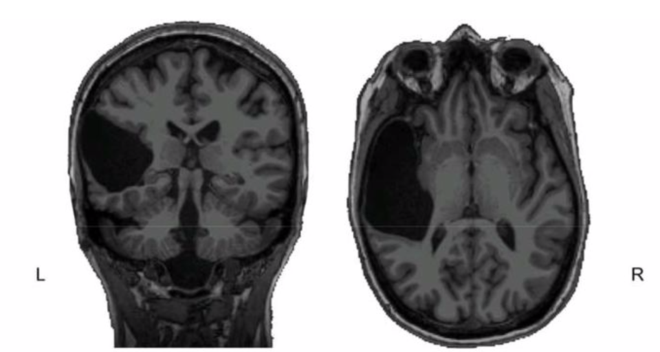 Credit: Evelina Fedorenko et al, bioRxiv.org, 2021