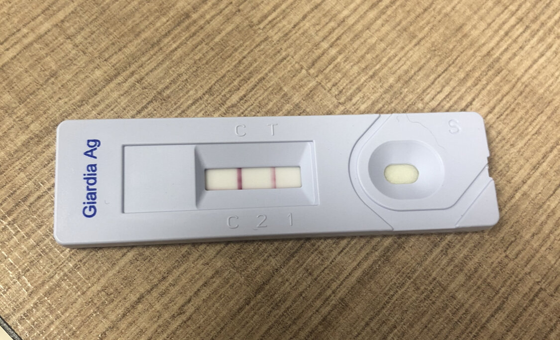 Тест на гиаргии (лямблии) 