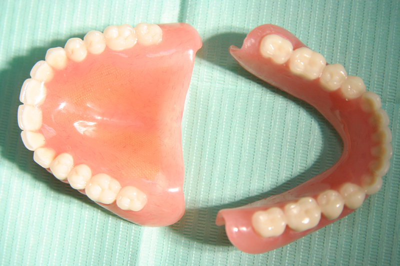 Фото съемных зубных протезов на обе челюсти