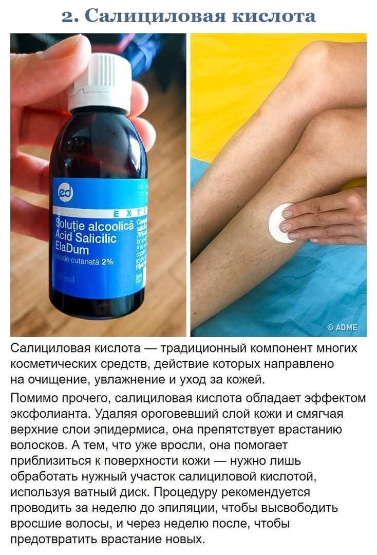 Салициловая кислота от вросших волос. Перечислите типы вросших волос. Спиралевидное врастание волос. Причины врастания волос. Как предотвратить врастание.