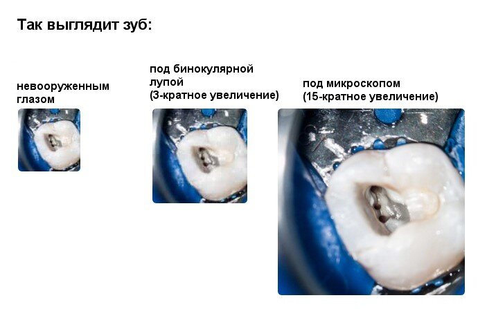 Осмотр полости рта ребенка