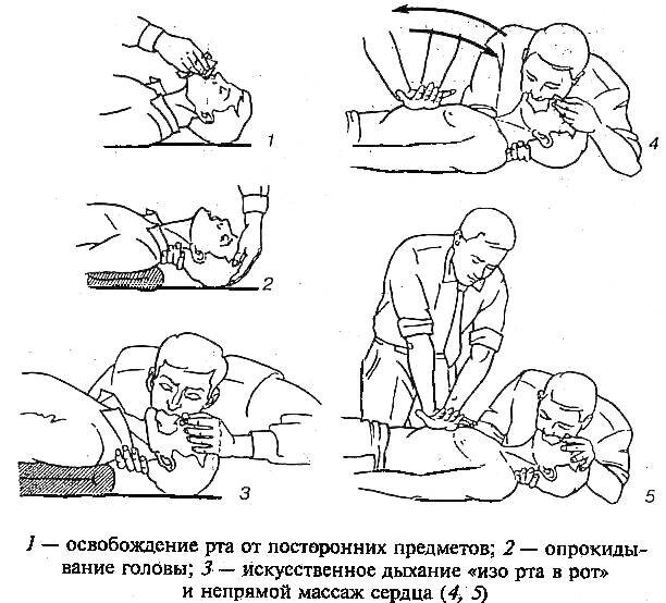 Все делали не так. А ведь в РЖД, ежемесячно проводится техническая учеба, одна из тем всегда "оказание первой помощи в разных ситуациях", но конечно, проводится формально. Даже манекен Федор лежит для красоты.  /Фото из открытых источников в интернете/ 