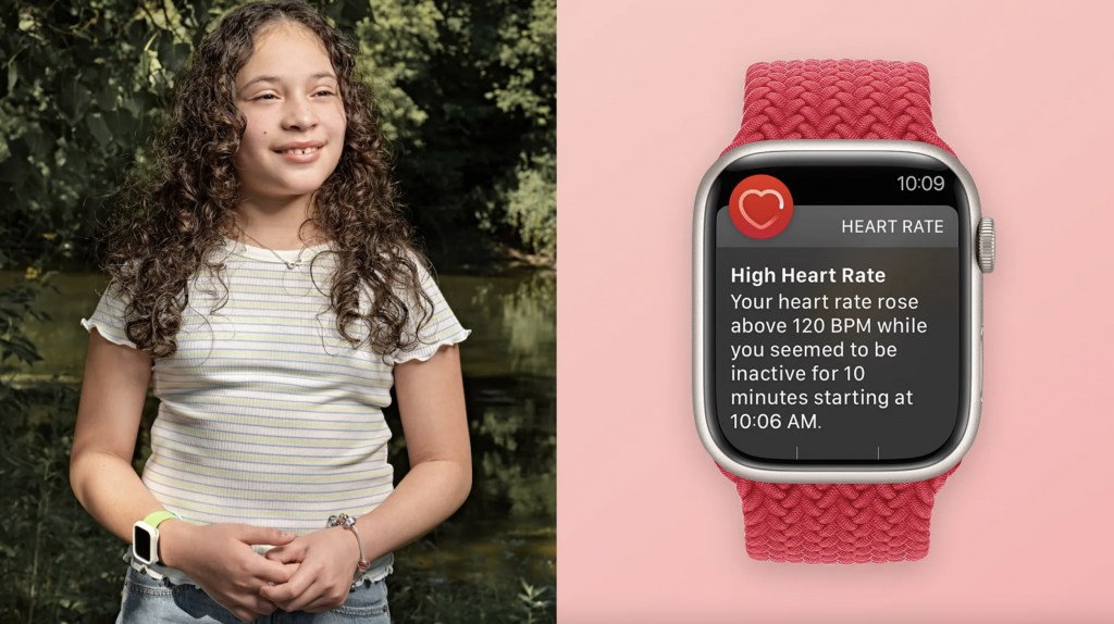    Apple Watch