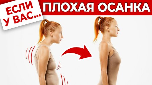 Как исправить осанку за ОДНУ минуту? | ДВА лучших упражнения для спины