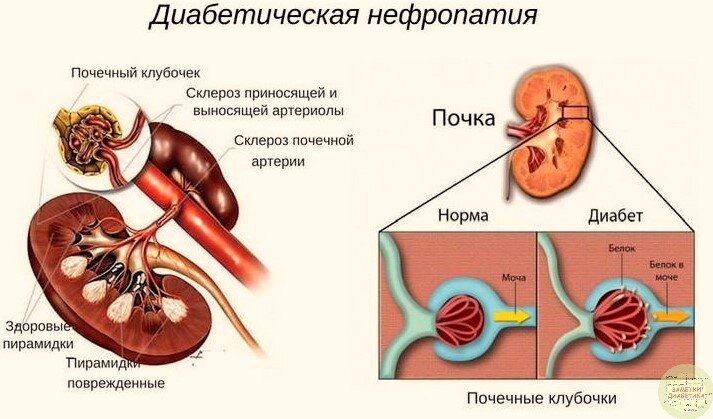 Фото взято с сервиса Яндекс.Картинки