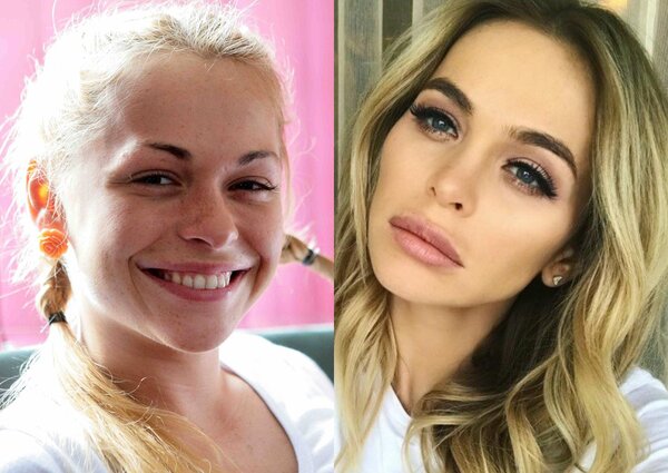 Актриса-красавица Анна Хилькевич до и после пластики
