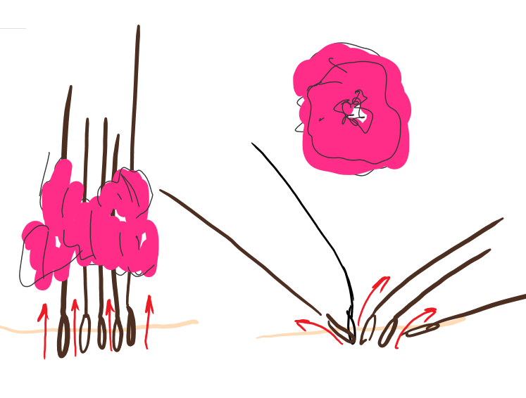 Резинка долго держит волосы в одном положении, а когда снимается, волосы распадаются и луковицы смещаются, вызывая боль