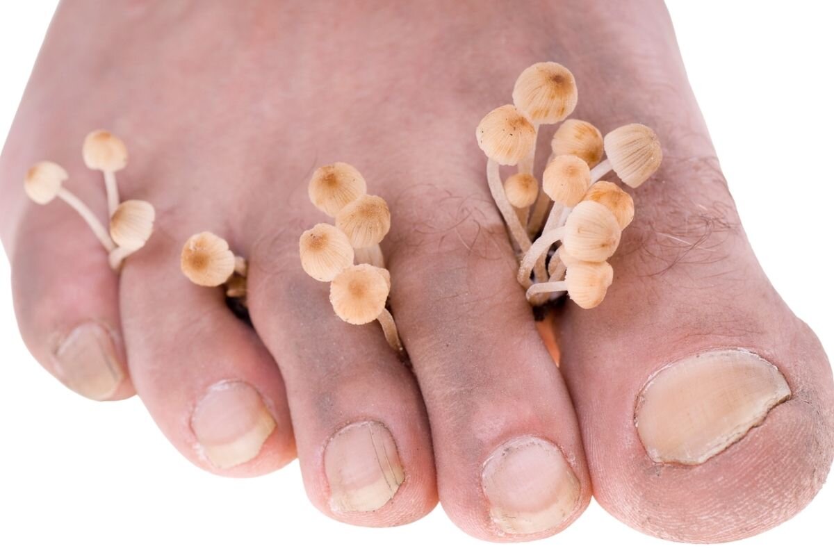 Будь здоровым, подписуйся.