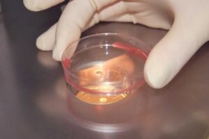 Яндекс-фото