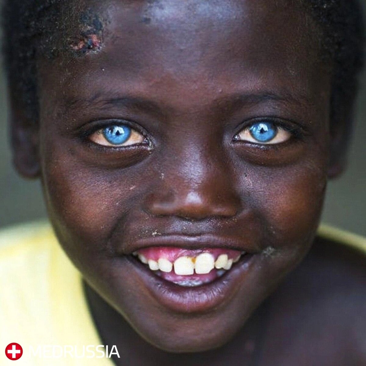 #здоровье #медицина #жизнь