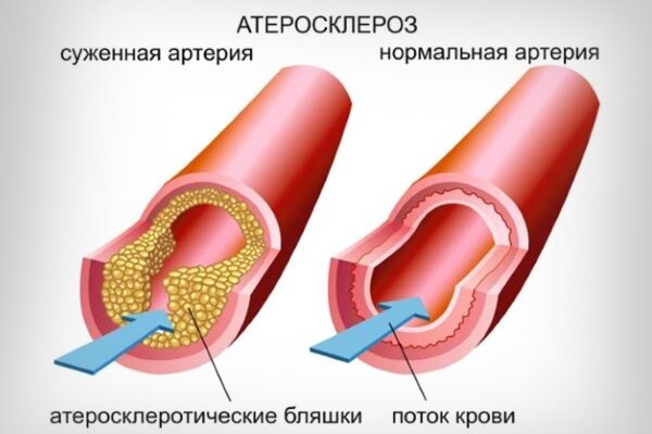 Источник изображения vse-sekrety.ru