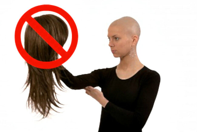 Выпадение волос при лечении онкологических заболеваний