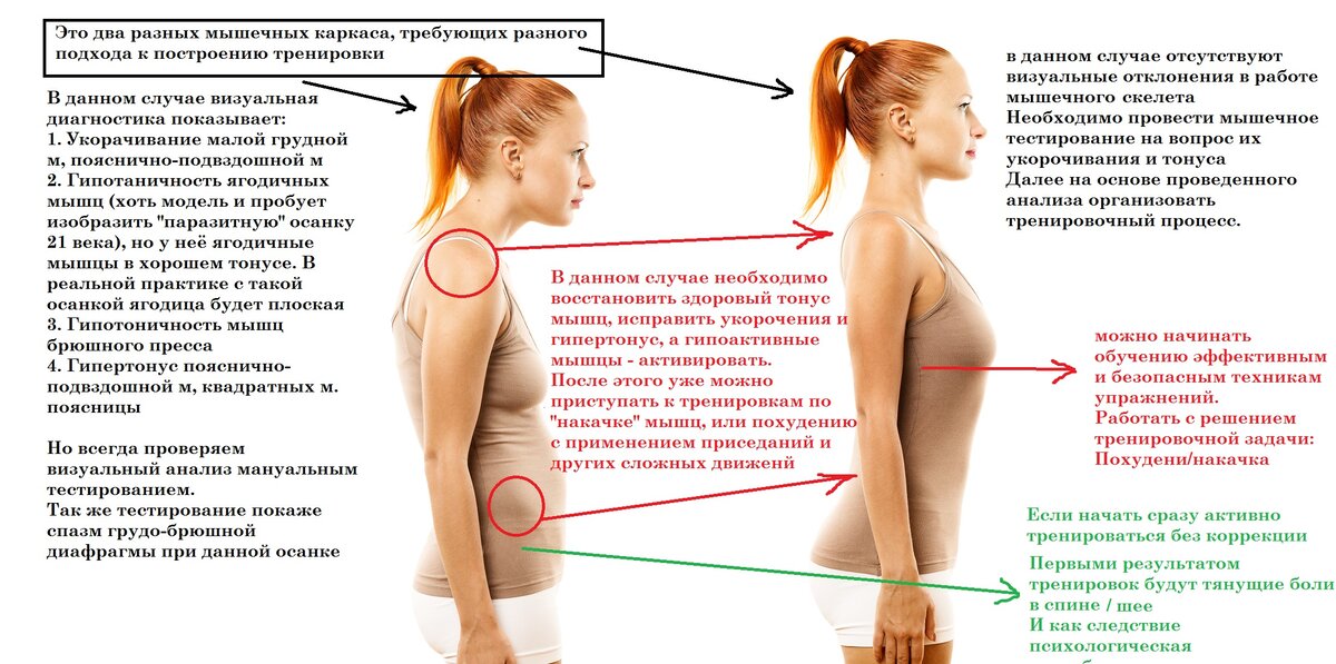 Боли в спине после физической нагрузки