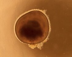 Первый выращенный 3D-мини-глаз из стволовых клеток детей с синдромом Ашера